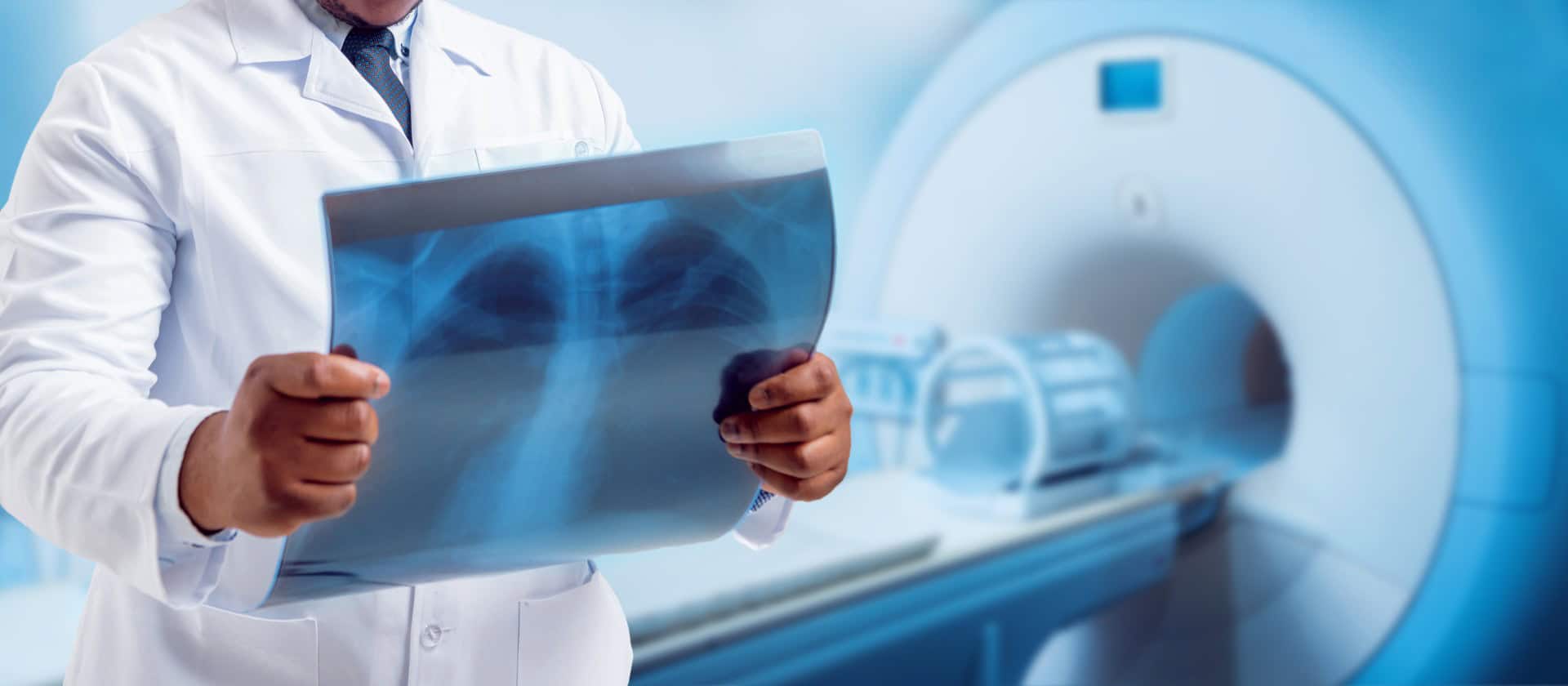 Differenzierte Strahlentherapie bei Lungenkrebs